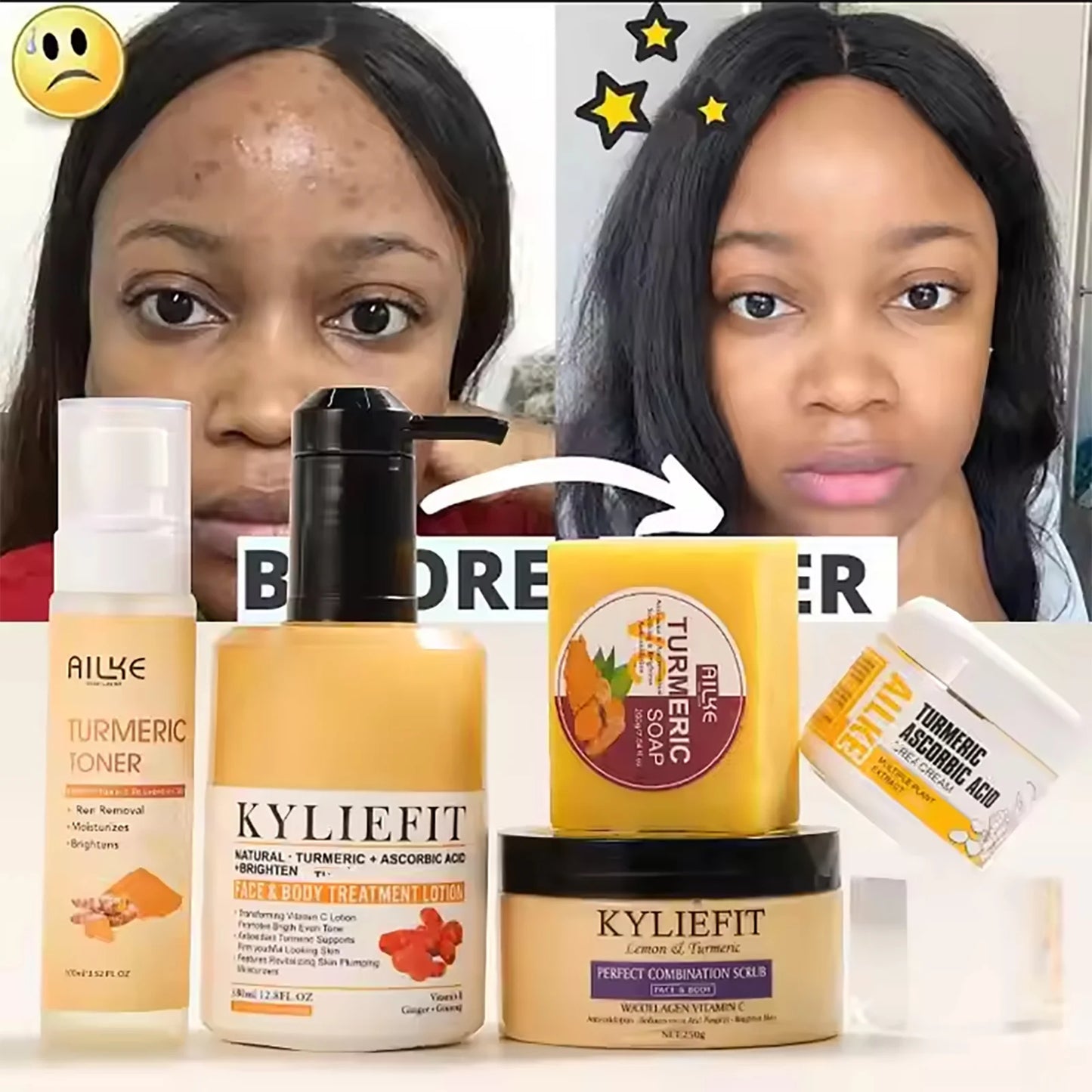 AILKE Organic Turmeric Skin Care Set for Acne Whitening