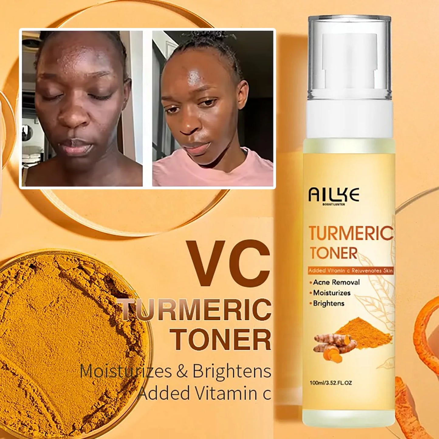 AILKE Organic Turmeric Skin Care Set for Brightening Acne