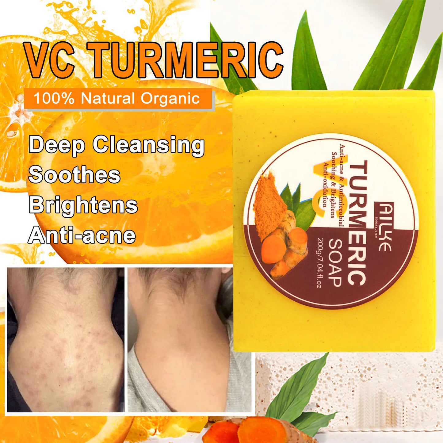 AILKE Organic Turmeric Skin Care Set for Acne Whitening