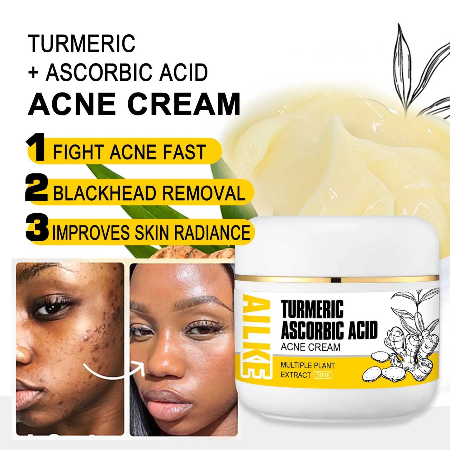 AILKE Organic Turmeric Skin Care Set for Brightening Acne