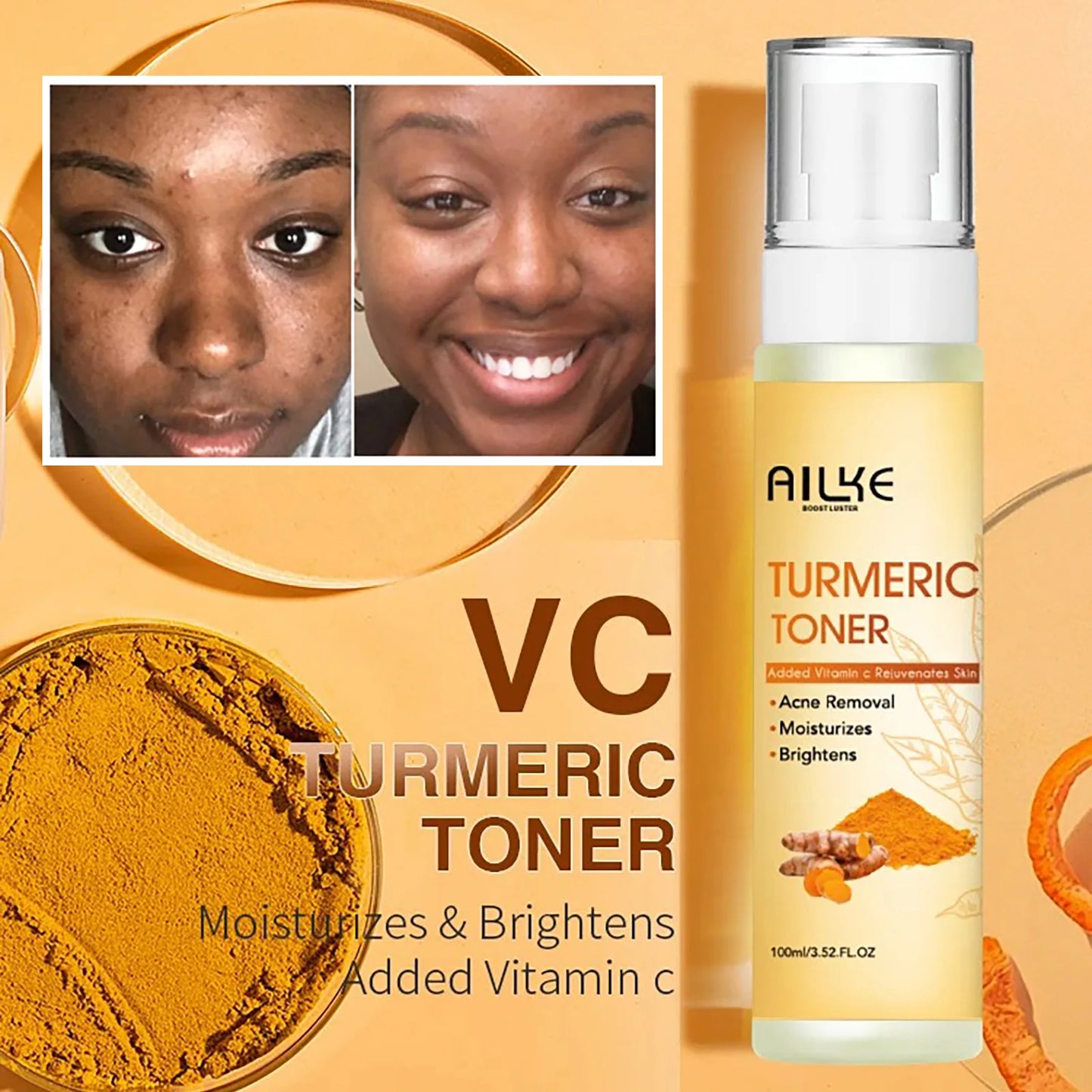 AILKE Organic Turmeric Skin Care Set for Brightening Acne