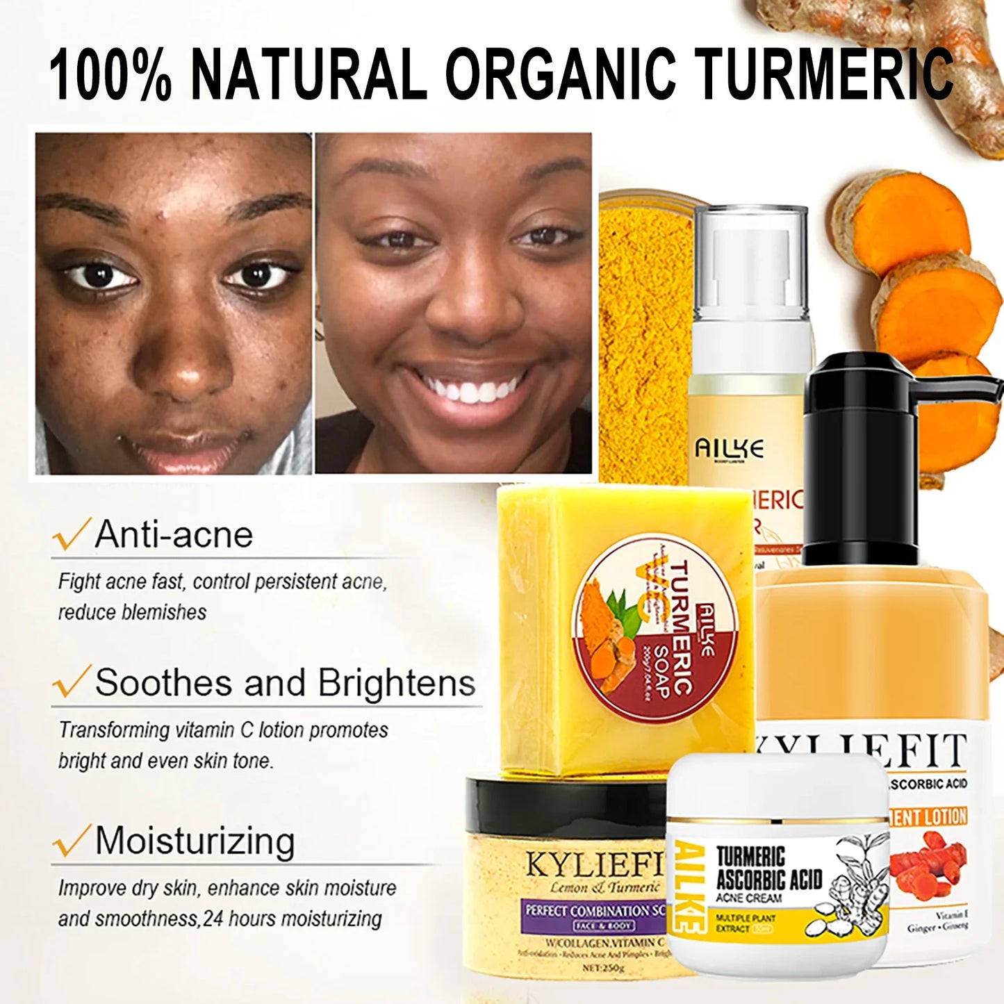 AILKE Organic Turmeric Skin Care Set for Brightening Acne